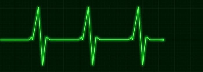 How support and resistance zones work in forex trading